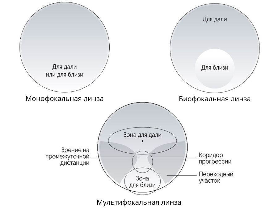 монофокальные, бифокальные и прогрессивные линзы